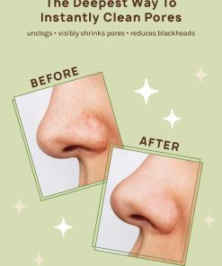 Alternative view of AOA Skin Charcoal Nose Strip