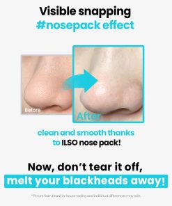 Alternative view of ilso Natural Mild Clear Nose Pack