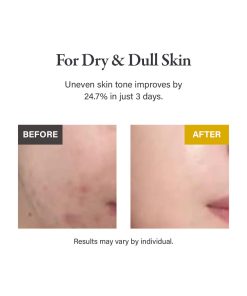 Alternative view of medicube Kojic Acid Turmeric Night Wrapping Mask 75ml