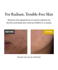 Alternative view of medicube Kojic Acid Turmeric Pad (70 Pads)