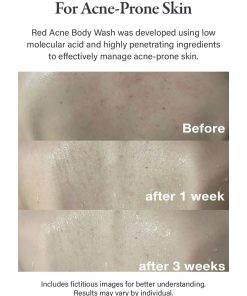 Alternative view of medicube Red Body Wash 400g